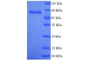 SDS-PAGE (SDS) image for Glypican 6 (GPC6) (AA 24-529) protein (His tag) (ABIN4976201)