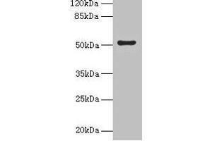 Western blot All lanes: SLC46A3 antibody at 4 μg/mL + Jurkat whole cell lysate Secondary Goat polyclonal to rabbit IgG at 1/10000 dilution Predicted band size: 52, 43 kDa Observed band size: 52 kDa