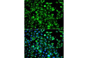 Immunofluorescence analysis of A549 cells using CAPN5 antibody (ABIN5975527). (Calpain 5 antibody)
