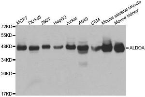 Western blot analysis of extracts of various cell lines, using ALDOA antibody.