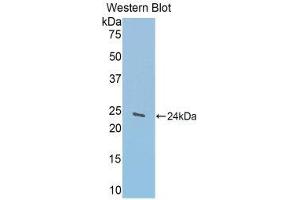 Western Blotting (WB) image for anti-Glycine Dehydrogenase (GLDC) (AA 81-268) antibody (ABIN1176540) (GLDC antibody  (AA 81-268))