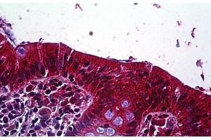 Human Colon, Epithelium: Formalin-Fixed, Paraffin-Embedded (FFPE) (LRP4 antibody  (AA 1765-1777))