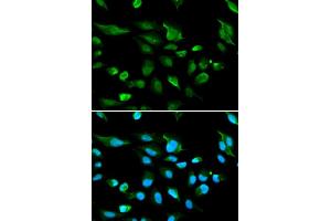 Immunofluorescence analysis of A549 cell using AIRE antibody. (AIRE antibody)