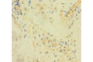 Immunohistochemistry of paraffin-embedded human placenta tissue using ABIN7144701 at dilution of 1:100 (Arylsulfatase I antibody  (AA 301-569))