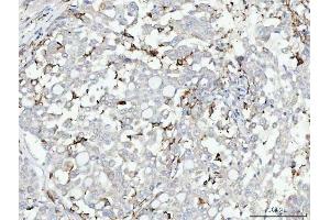 IHC analysis of CD14 using anti-CD14 antibody (ABIN3044565).