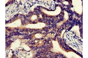 ABCA5 antibody  (AA 1230-1355)
