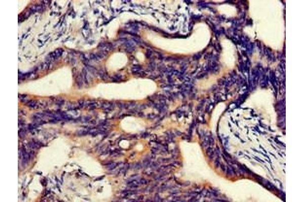 ABCA5 antibody  (AA 1230-1355)