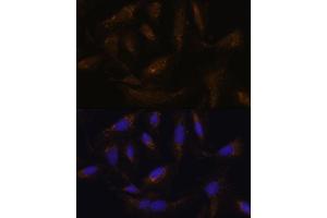 Immunofluorescence analysis of U-2 OS cells using UCP4 antibody (ABIN6132767, ABIN6147925, ABIN6147927 and ABIN6217968) at dilution of 1:100. (SLC25A27 antibody  (AA 1-245))