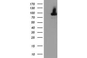 Western Blotting (WB) image for anti-Arachidonate 15-Lipoxygenase (ALOX15) antibody (ABIN1496360) (ALOX15 antibody)