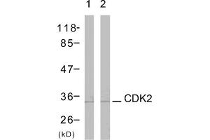 Western blot analysis using CDK2 (epitope around residue 161) Antibody (ABIN5976214) Line1: The extracts from A2780 cells (CDK1 antibody  (Thr161))