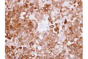 IHC-P Image Immunohistochemical analysis of paraffin-embedded CL1-0 xenograft, using NQO1, antibody at 1:500 dilution. (NQO1 antibody  (C-Term))