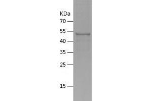 Western Blotting (WB) image for Golgi Reassembly Stacking Protein 1, 65kDa (GORASP1) (AA 221-440) protein (His tag) (ABIN7283347) (GORASP1 Protein (AA 221-440) (His tag))