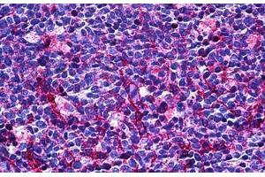 Human Tonsil: Formalin-Fixed, Paraffin-Embedded (FFPE) (CD31 antibody  (AA 686-735))