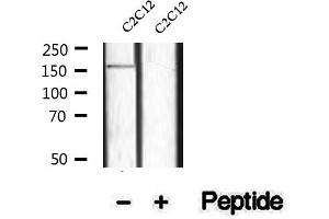 Western blot analysis of extracts of C2C12 cells, using Phospho-TBC1D1 (Ser237) Antibody.