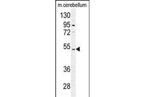 CNGA4 抗体  (N-Term)