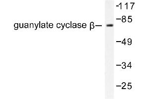 Image no. 1 for anti-Guanylate Cyclase 1, Soluble, beta 3 (GUCY1B3) antibody (ABIN265451) (GUCY1B3 antibody)