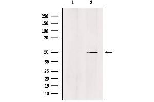 Western blot analysis of extracts from Hela, using ZFYVE19 Antibody.