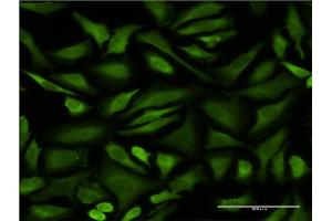 Immunofluorescence of monoclonal antibody to STIP1 on HeLa cell. (STIP1 antibody  (AA 445-543))
