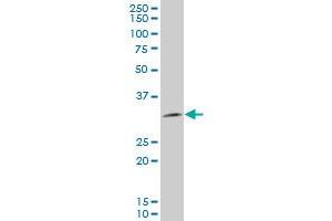 TPM3 polyclonal antibody (A01), Lot # Abnova060503QCS1 Western Blot analysis of TPM3 expression in HeLa . (TPM3 antibody  (AA 1-248))