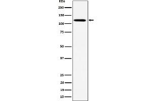 Western blot analysis of KIF5B expression in HeLa cell lysate. (Recombinant KIF5B antibody)