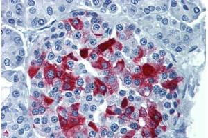 Human Pancreas: Formalin-Fixed, Paraffin-Embedded (FFPE) (RBP4 antibody  (AA 19-202))