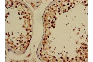 Immunohistochemistry of paraffin-embedded human testis tissue using ABIN7153414 at dilution of 1:100 (GABPB2 antibody  (AA 163-440))