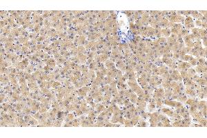 Detection of FTH in Human Liver Tissue using Monoclonal Antibody to Ferritin, Heavy Polypeptide (FTH) (FTH1 antibody  (AA 1-183))