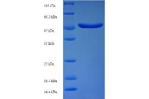 SDS-PAGE (SDS) image for Cyclin-Dependent Kinase Inhibitor 1A (p21, Cip1) (CDKN1A) (AA 425-719), (partial) protein (His-SUMO Tag) (ABIN5711920) (p21 Protein (AA 425-719, partial) (His-SUMO Tag))