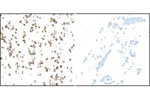 Immunocytochemistry (ICC) image for anti-Ubiquitin Carboxyl-terminal Esterase L1 (Ubiquitin Thiolesterase) (UCHL1) (AA 50-100) antibody (ABIN7449527) (Recombinant UCHL1 antibody  (AA 50-100))