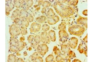 Immunohistochemistry of paraffin-embedded human pancreatic tissue using ABIN7160859 at dilution of 1:100 (SIRT3 antibody  (AA 20-130))