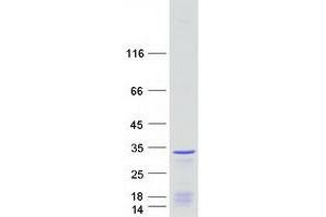 Validation with Western Blot