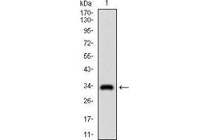 Western blot analysis using GSC mAb against human GSC recombinant protein. (GSC antibody  (AA 191-257))