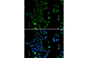 Immunofluorescence analysis of MCF-7 cells using GCM1 antibody (ABIN5974384). (GCM1 antibody)
