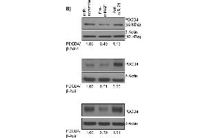 Western Blotting (WB) image for anti-Programmed Cell Death 4 (PDCD4) (pSer457) antibody (ABIN129708)