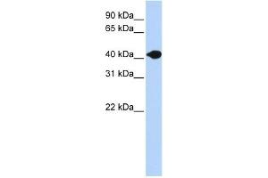 DNASE2B antibody used at 1 ug/ml to detect target protein. (DNASE2B antibody  (N-Term))