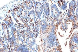 Immunohistochemistry of paraffin-embedded mouse intestin using FABPI Rabbit mAb (ABIN7267151) at dilution of 1:100 (40x lens). (FABP2 antibody)