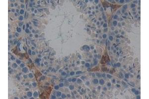 Detection of GSTt2 in Mouse Testis Tissue using Polyclonal Antibody to Glutathione S Transferase Theta 2 (GSTt2) (GSTT2 antibody  (AA 15-216))
