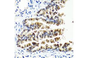 Immunohistochemistry of paraffin-embedded mouse lung using SIRT1 antibody (ABIN5970059) at dilution of 1/100 (40x lens). (SIRT1 antibody  (C-Term))