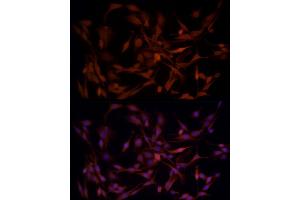 Immunofluorescence analysis of PC-12 cells using B1 Rabbit pAb (ABIN3022390, ABIN3022391, ABIN3022392, ABIN1512555 and ABIN6218779) at dilution of 1:50 (40x lens). (AKR1B1 antibody  (AA 1-316))