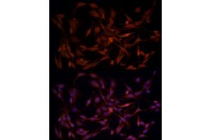Immunofluorescence analysis of PC-12 cells using B1 Rabbit pAb (ABIN3022390, ABIN3022391, ABIN3022392, ABIN1512555 and ABIN6218779) at dilution of 1:50 (40x lens). (AKR1B1 antibody  (AA 1-316))