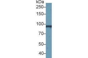 Detection of GSN in Bovine Skeletal muscle lysate using Monoclonal Antibody to Gelsolin (GSN) (Gelsolin antibody  (AA 432-553))