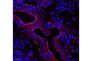 Immunofluorescence of paraffin embedded rat ovary using NRG2 (ABIN7074804) at dilution of 1: 500 (400x lens) (Neuregulin 2 antibody)
