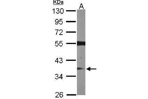 WB Image Sample (50 ug of whole cell lysate) A: Mouse brain 10% SDS PAGE antibody diluted at 1:1000 (RASSF2 antibody  (Center))