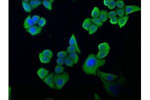 Immunofluorescence staining of Hela cells with ABIN7140135 at 1:100, counter-stained with DAPI. (Sestrin 2 antibody  (AA 42-61))