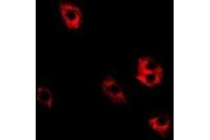Immunofluorescent analysis of SRP19 staining in Hela cells. (SRP19 antibody)