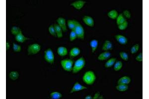 Immunofluorescent analysis of A549 cells using ABIN7144679 at dilution of 1:100 and Alexa Fluor 488-congugated AffiniPure Goat Anti-Rabbit IgG(H+L) (NAT2 antibody  (AA 1-290))