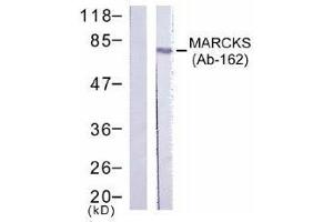 Image no. 1 for anti-Myristoylated Alanine-Rich Protein Kinase C Substrate (MARCKS) (Ser162) antibody (ABIN197519) (MARCKS antibody  (Ser162))