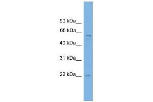 FTO antibody used at 1 ug/ml to detect target protein.