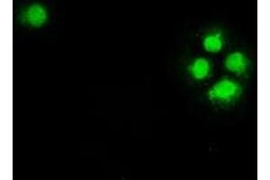 Anti-CHEK2 mouse monoclonal antibody (ABIN2452258) immunofluorescent staining of COS7 cells transiently transfected by pCMV6-ENTRY CHEK2 (RC201278). (CHEK2 antibody)