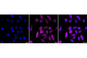 anti-Prolyl 4-Hydroxylase, Transmembrane (Endoplasmic Reticulum) (P4HTM) antibody